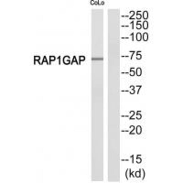 Western blot - RAP1GDS1 Antibody from Signalway Antibody (34960) - Antibodies.com