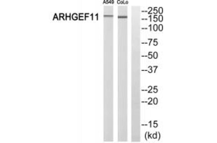 Western blot - ARHGEF11 Antibody from Signalway Antibody (34991) - Antibodies.com