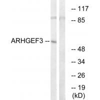 Western blot analysis of extracts from COLO cells, using ARHGEF3 antibody #34995.