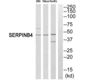 Western blot - SERPINB4 Antibody from Signalway Antibody (35036) - Antibodies.com