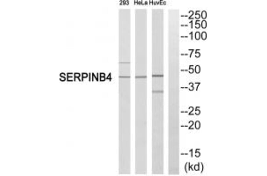 Western blot - SERPINB4 Antibody from Signalway Antibody (35036) - Antibodies.com