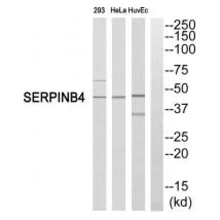 Western blot - SERPINB4 Antibody from Signalway Antibody (35036) - Antibodies.com