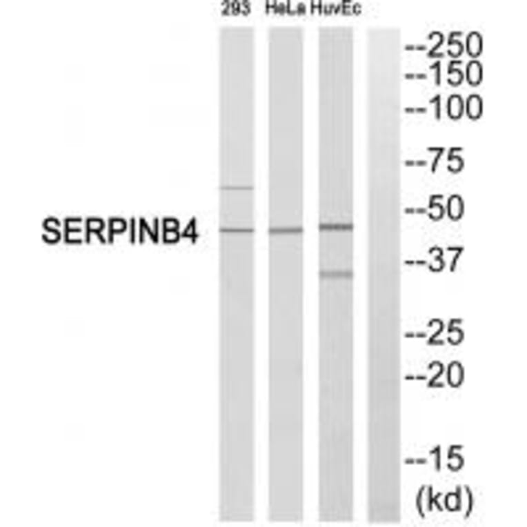 Western blot - SERPINB4 Antibody from Signalway Antibody (35036) - Antibodies.com