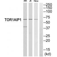 Western blot analysis of extracts from 293 cells, Jurkat cells and HeLa cells, using TOR1AIP1 antibody #35097.