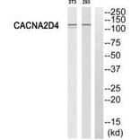 Western blot - CACNA2D4 Antibody from Signalway Antibody (35144) - Antibodies.com