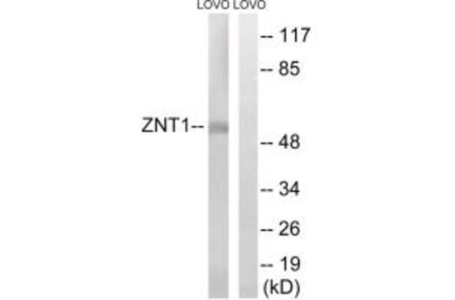 Western blot - SLC30A1 Antibody from Signalway Antibody (35160) - Antibodies.com