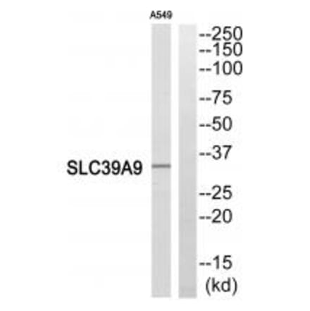 Western blot - SLC39A9 Antibody from Signalway Antibody (35163) - Antibodies.com