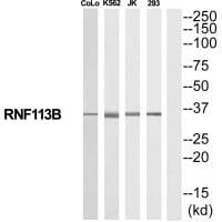 Western blot analysis of extracts from COLO205/K562/Jurkat/293 cells, using RNF113B antibody #35192.