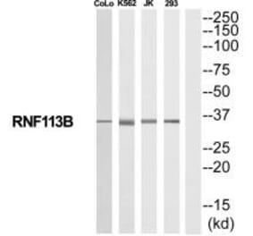 Western blot - RNF113B Antibody from Signalway Antibody (35192) - Antibodies.com