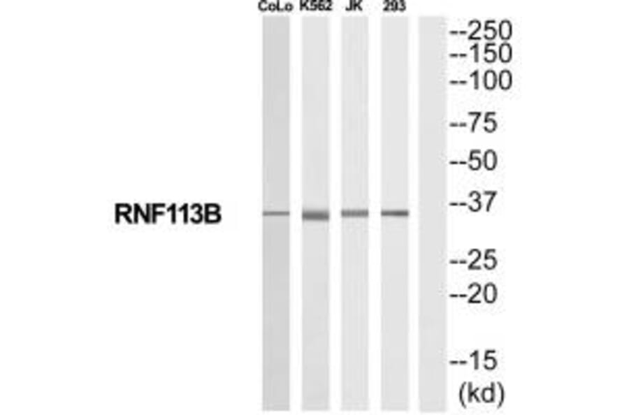 Western blot - RNF113B Antibody from Signalway Antibody (35192) - Antibodies.com
