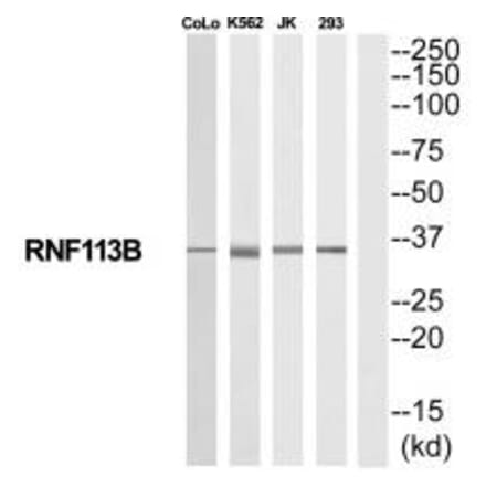 Western blot - RNF113B Antibody from Signalway Antibody (35192) - Antibodies.com