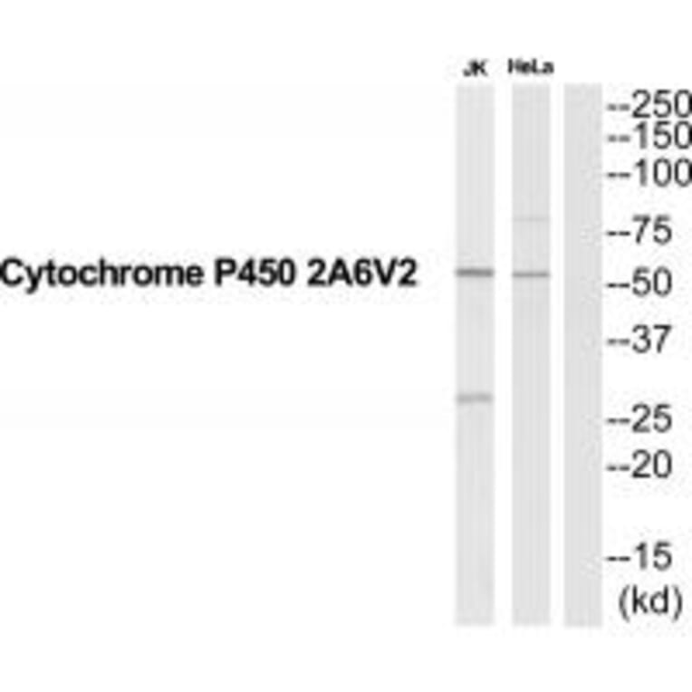 Western blot - CYP2A6V2 Antibody from Signalway Antibody (35265) - Antibodies.com