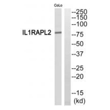 Western blot - IL1RAPL2 Antibody from Signalway Antibody (35317) - Antibodies.com