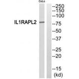 Western blot - IL1RAPL2 Antibody from Signalway Antibody (35317) - Antibodies.com