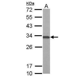 ATP6V1E1 Antibody from Signalway Antibody (35378) - Antibodies.com
