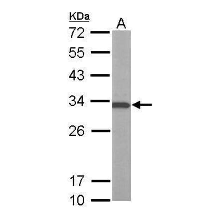 ATP6V1E1 Antibody from Signalway Antibody (35378) - Antibodies.com