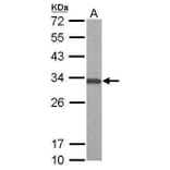 ATP6V1E1 Antibody from Signalway Antibody (35378) - Antibodies.com