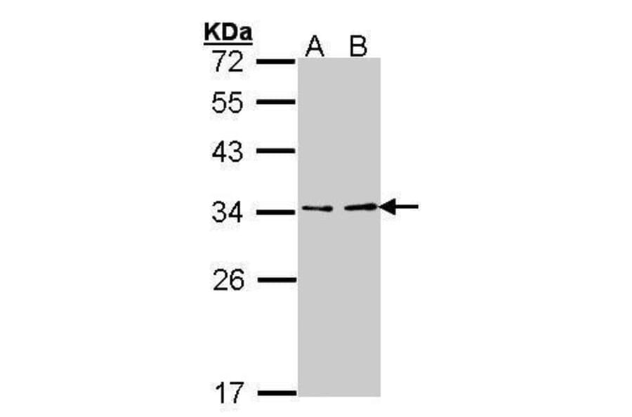 ATP6V1E1 Antibody from Signalway Antibody (35378) - Antibodies.com
