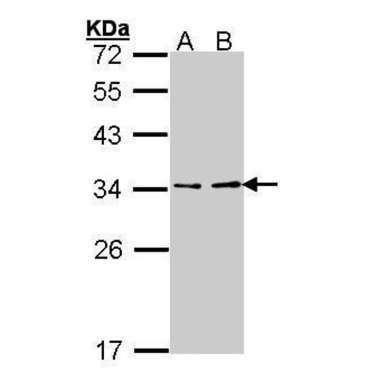 ATP6V1E1 Antibody from Signalway Antibody (35378) - Antibodies.com