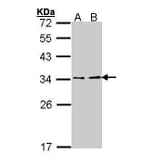 ATP6V1E1 Antibody from Signalway Antibody (35378) - Antibodies.com