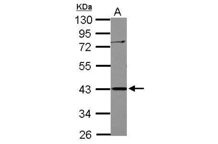 APOBEC3G Antibody from Signalway Antibody (35502) - Antibodies.com