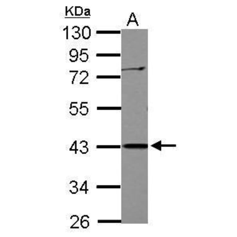 APOBEC3G Antibody from Signalway Antibody (35502) - Antibodies.com