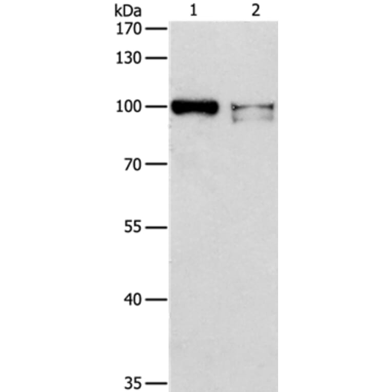 ADAMTSL2 Antibody from Signalway Antibody (36046) - Antibodies.com