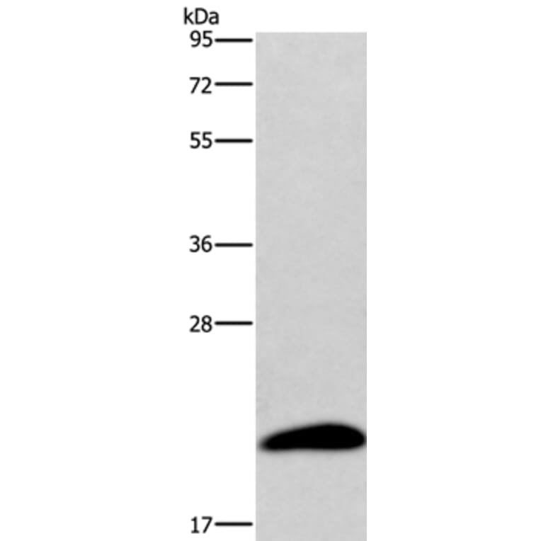 AURKAIP1 Antibody from Signalway Antibody (36255) - Antibodies.com