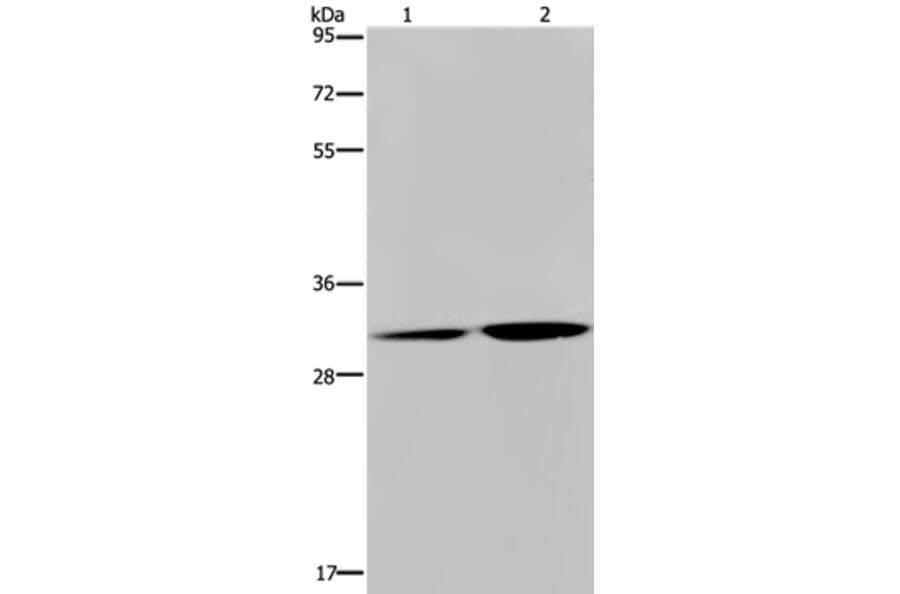 DNASE1L3 Antibody from Signalway Antibody (36420) - Antibodies.com