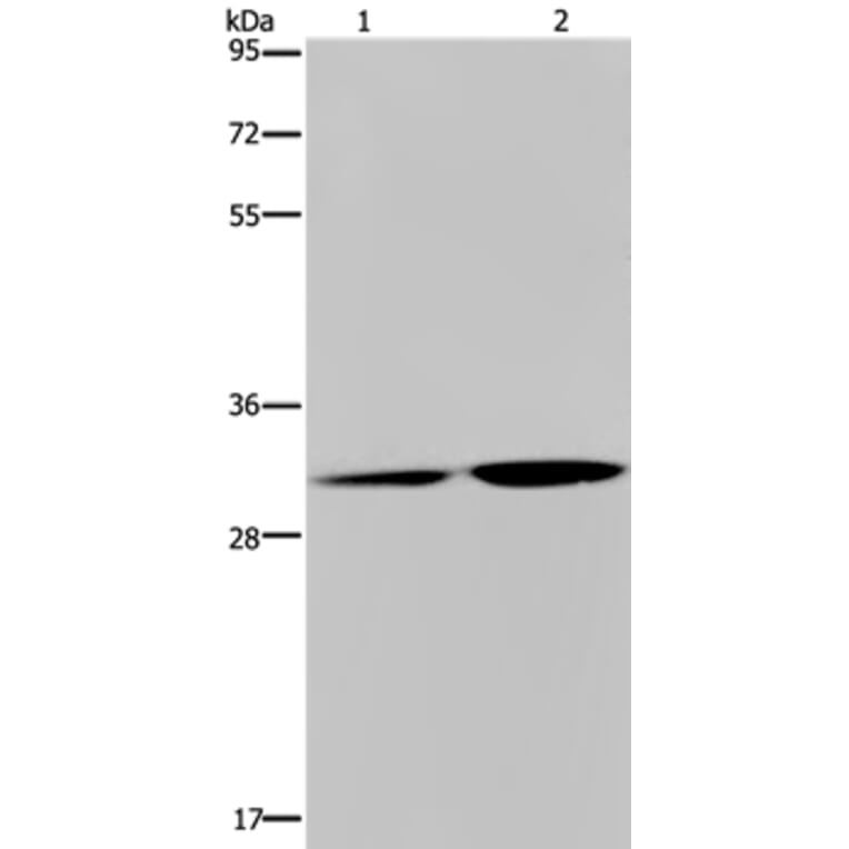 DNASE1L3 Antibody from Signalway Antibody (36420) - Antibodies.com