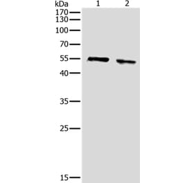 pan-AKT Antibody from Signalway Antibody (36716) - Antibodies.com