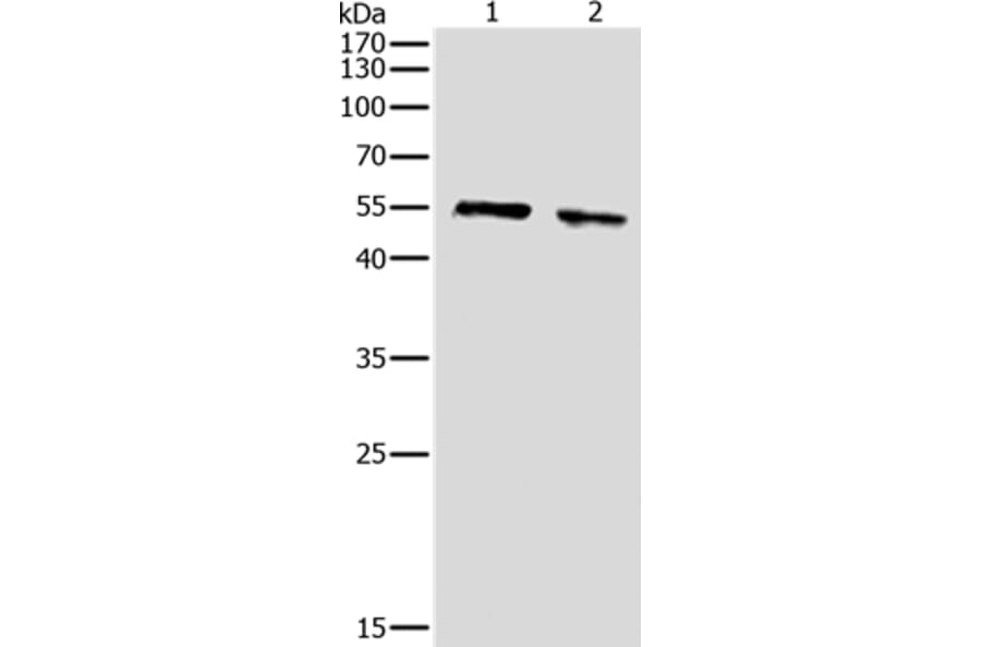 pan-AKT Antibody from Signalway Antibody (36716) - Antibodies.com