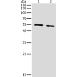pan-AKT Antibody from Signalway Antibody (36716) - Antibodies.com