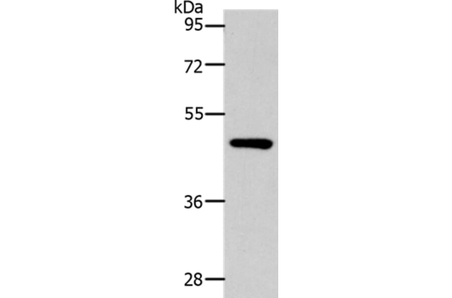 SLC16A14 Antibody from Signalway Antibody (36974) - Antibodies.com
