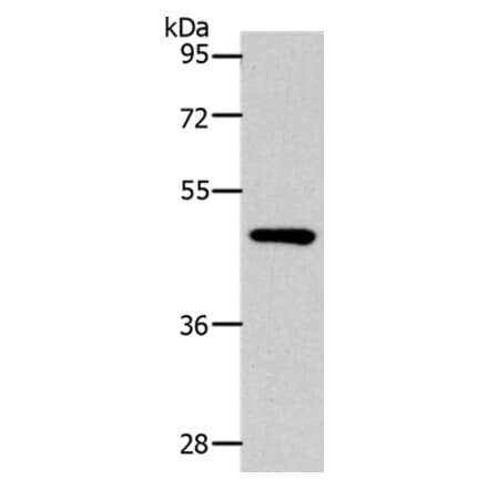 SLC16A14 Antibody from Signalway Antibody (36974) - Antibodies.com