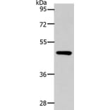SLC16A14 Antibody from Signalway Antibody (36974) - Antibodies.com