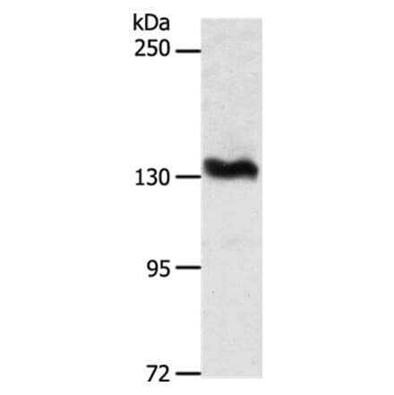 ADAMTS16 Antibody from Signalway Antibody (37314) - Antibodies.com