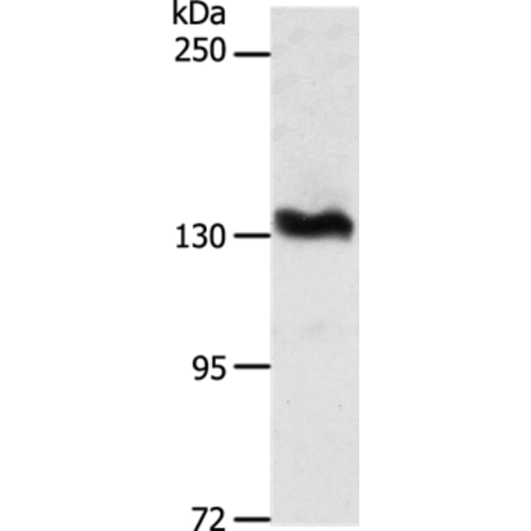 ADAMTS16 Antibody from Signalway Antibody (37314) - Antibodies.com