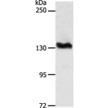 ADAMTS16 Antibody from Signalway Antibody (37314) - Antibodies.com