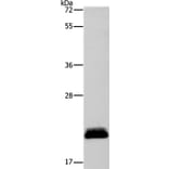 APOBEC3C Antibody from Signalway Antibody (37338) - Antibodies.com