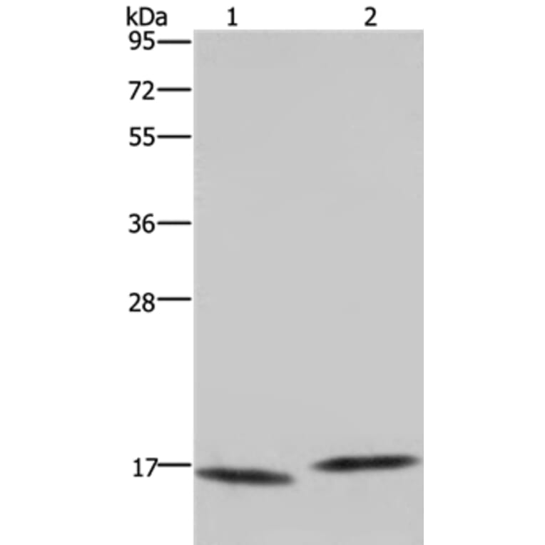 MAP1LC3C Antibody from Signalway Antibody (37700) - Antibodies.com