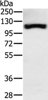 Gel: 8% SDS-PAGE Lysates (from left to right): Human fetal muscle tissue Amount of lysate: 40ug per lane Primary antibody: 1/300 dilution Secondary antibody dilution: 1/8000 Exposure time: 2 minutes