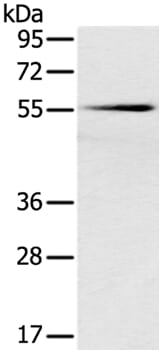 Gel: 8% SDS-PAGE Lysates (from left to right): Mouse pancreas tissue Amount of lysate: 40ug per lane Primary antibody: 1/200 dilution Secondary antibody dilution: 1/8000 Exposure time: 2 minutes