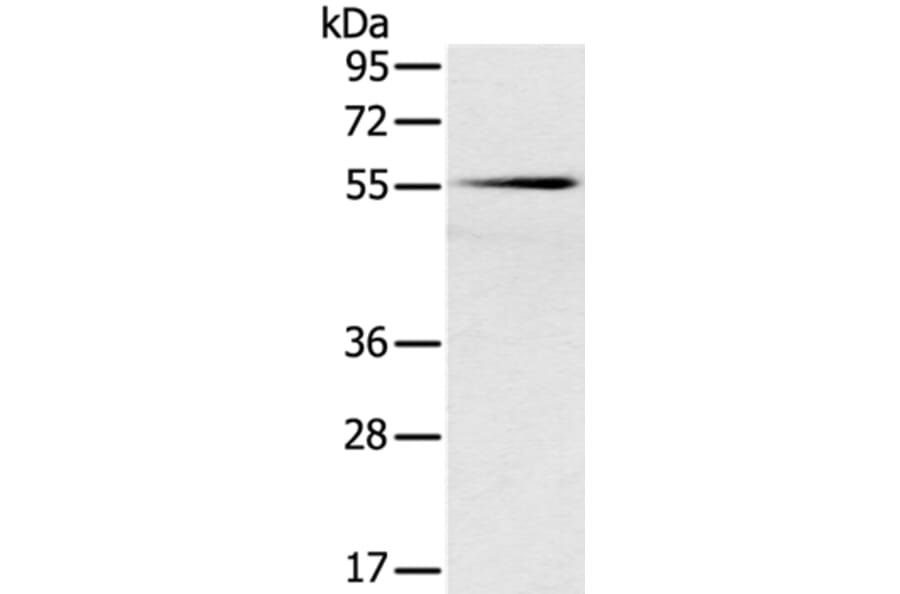 SLC16A10 Antibody from Signalway Antibody (37930) - Antibodies.com