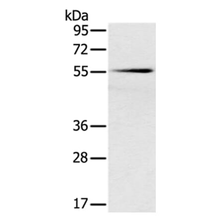 SLC16A10 Antibody from Signalway Antibody (37930) - Antibodies.com