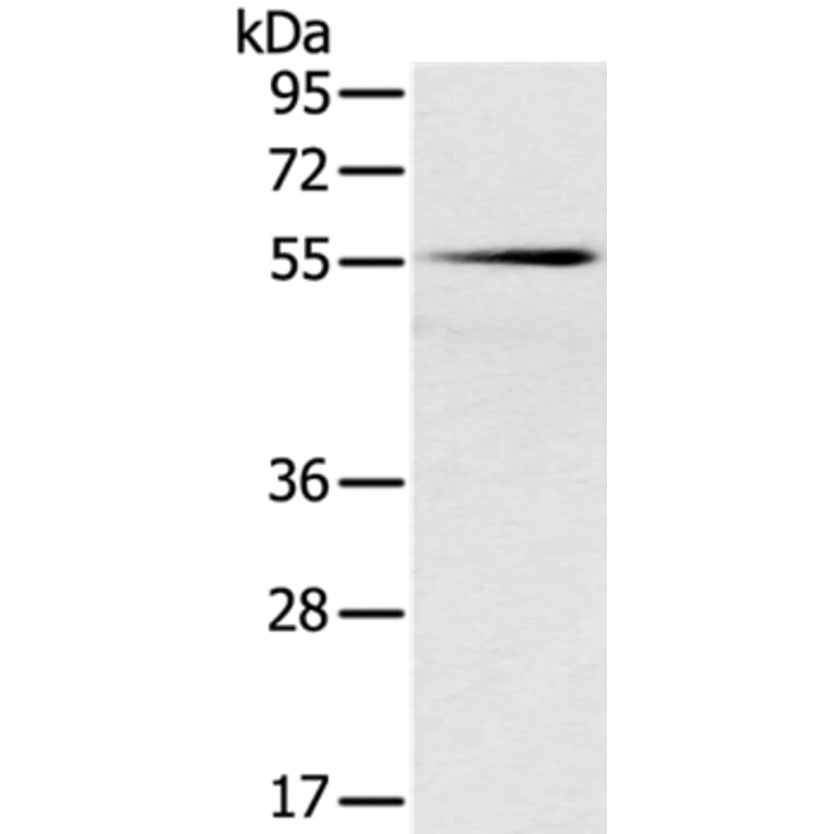 SLC16A10 Antibody from Signalway Antibody (37930) - Antibodies.com
