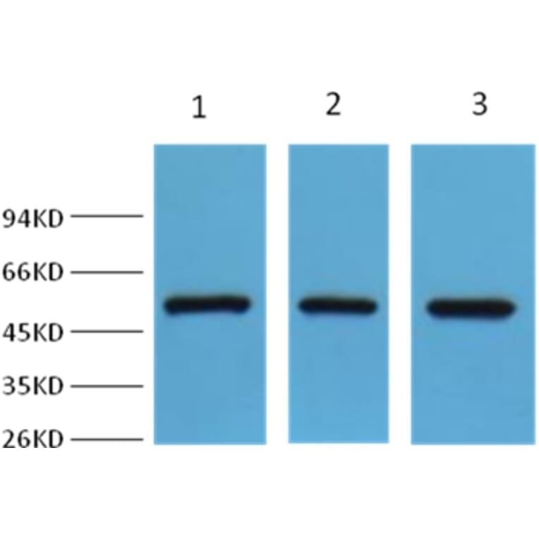 Western blot - Fumarase Antibody from Signalway Antibody (38002) - Antibodies.com