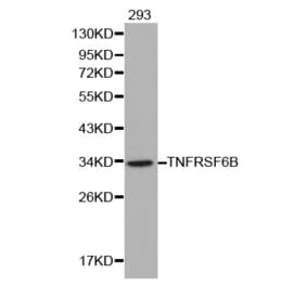Western blot - TNFRSF6B antibody from Signalway Antibody (38137) - Antibodies.com