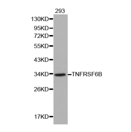 Western blot - TNFRSF6B antibody from Signalway Antibody (38137) - Antibodies.com