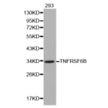 Western blot - TNFRSF6B antibody from Signalway Antibody (38137) - Antibodies.com